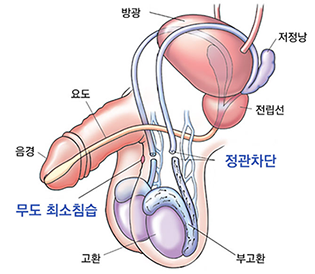 이미지명